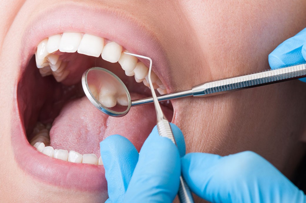 periodoncia en Carabanchel - tratamiento