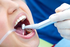 Clínica dental en Vista Alegre - Revisión