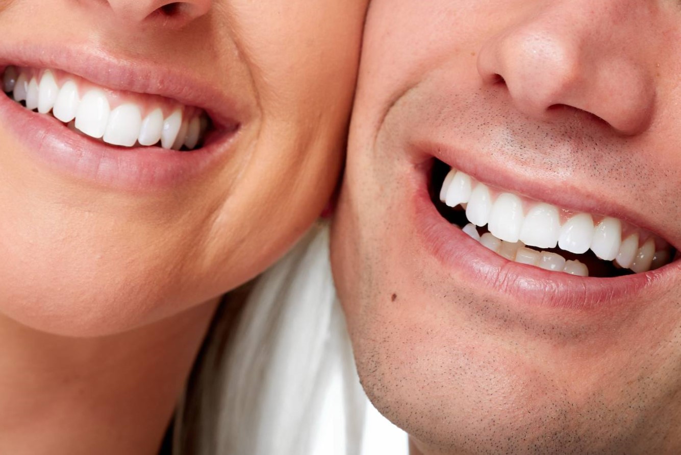 implantes dentales en carabanchel - sonrisas perfectas