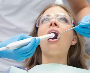 dentista en Carabanchel - limpieza dental