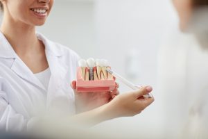 implantes dentales en carabanchel - dentista explicando los cuidados