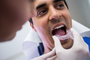 clínica dental Carabanchel - colocacion de retenedores