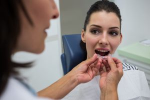 clínica dental Carabanchel - profesional colocando los retenedores