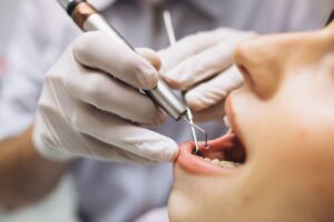 Clínica dental en caramanchel - revision