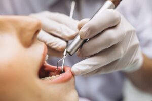 Implantología dental en Carabanchel - Dientes