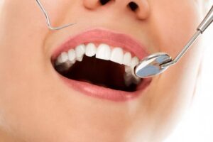 Mejor clínica dental en Carabanchel - Dientes