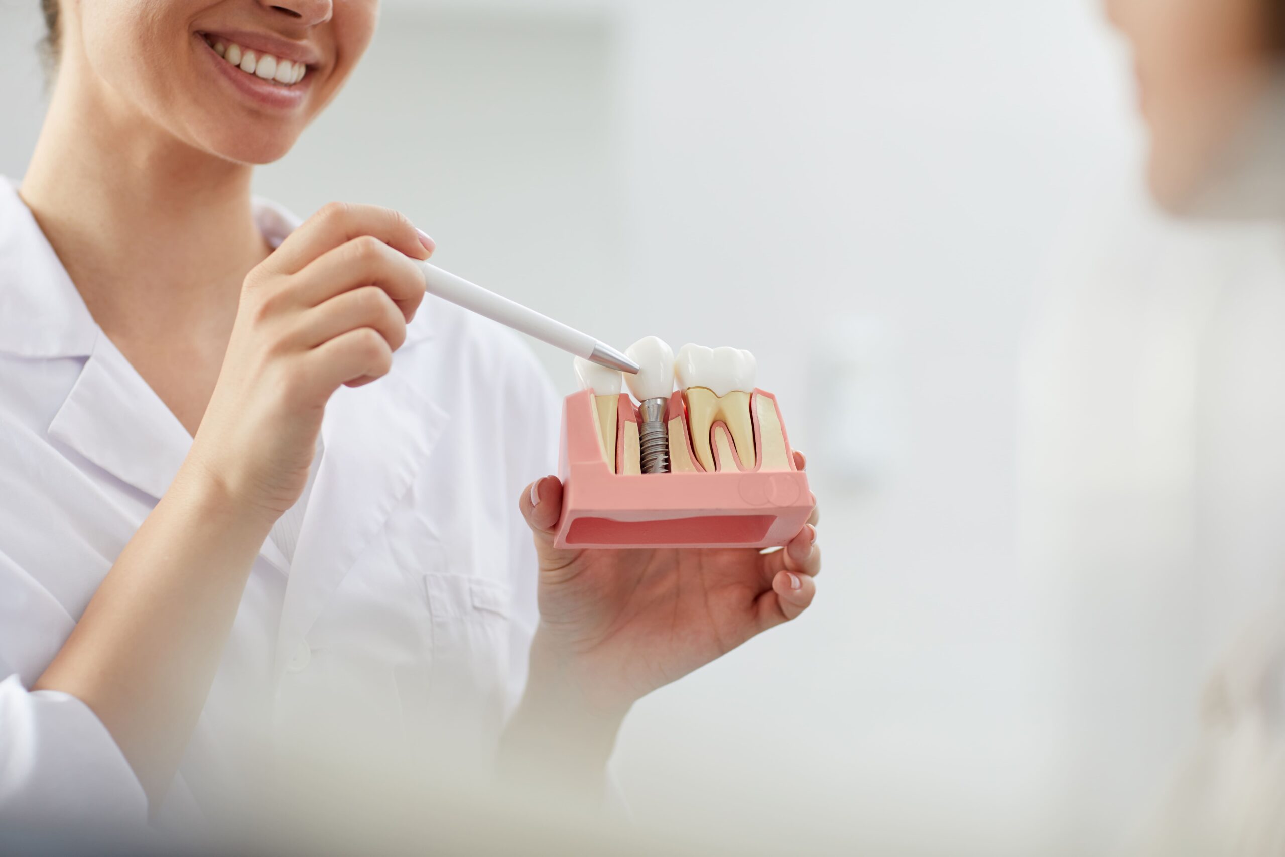 implantes dentales en carabanchel - prototipo