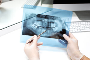 endodoncia en carabanchel - radio 