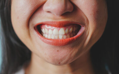 Encías inflamadas o sangrantes: ¿gingivitis o periodontitis?