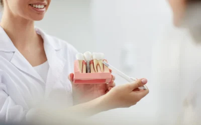 Implantes dentales: cuidados postoperatorios