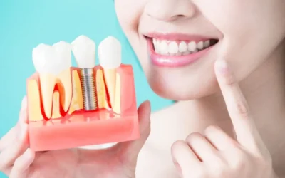 ¿Cómo puede mejorar mi vida con implantes dentales?